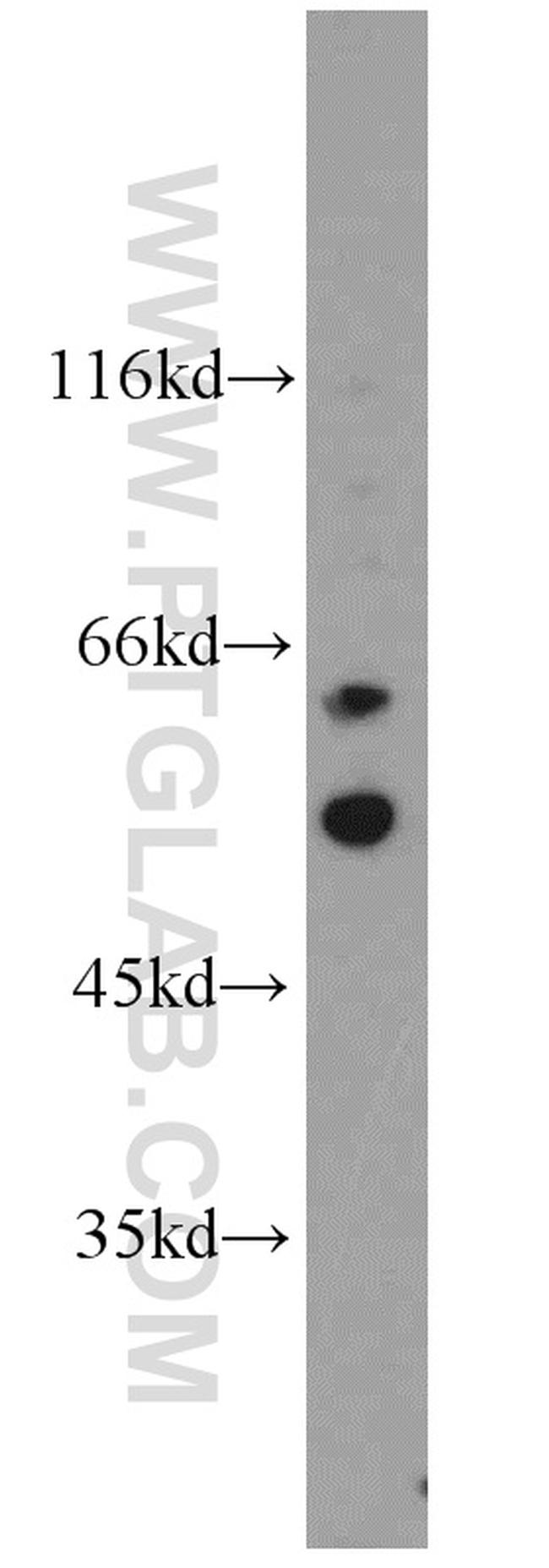 SRC Antibody in Western Blot (WB)