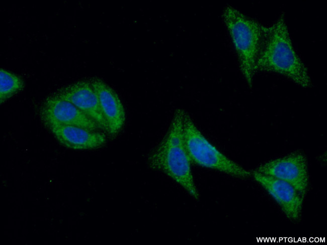 FGFR4 Antibody in Immunocytochemistry (ICC/IF)