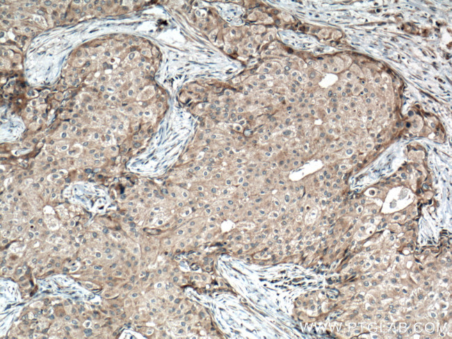 FGFR4 Antibody in Immunohistochemistry (Paraffin) (IHC (P))