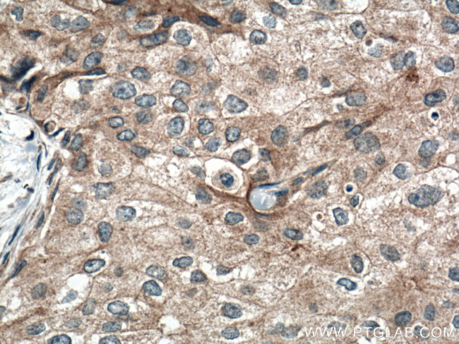 FGFR4 Antibody in Immunohistochemistry (Paraffin) (IHC (P))