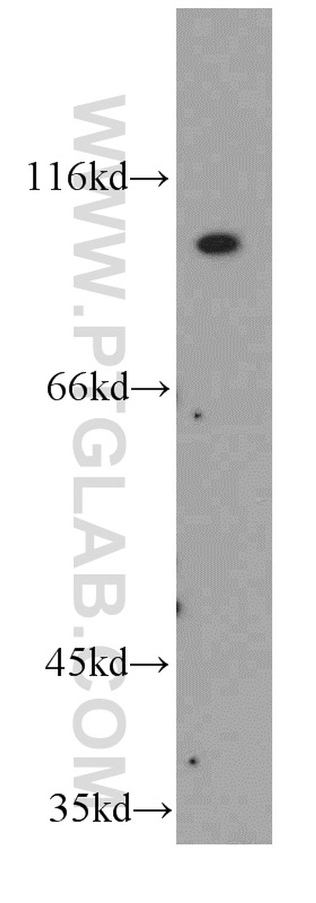 FGFR4 Antibody in Western Blot (WB)