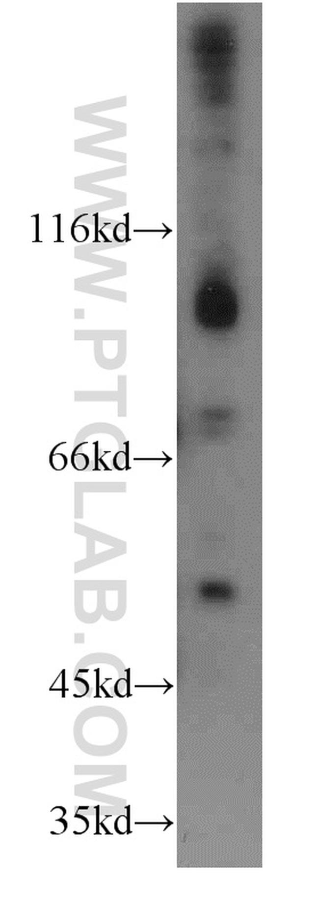 FGFR4 Antibody in Western Blot (WB)