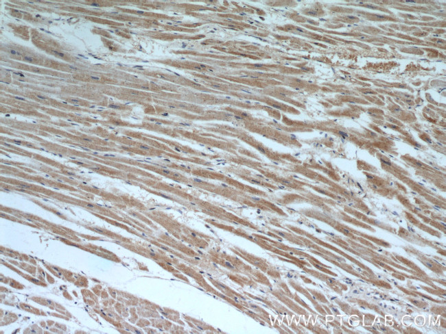 SHMT2 Antibody in Immunohistochemistry (Paraffin) (IHC (P))