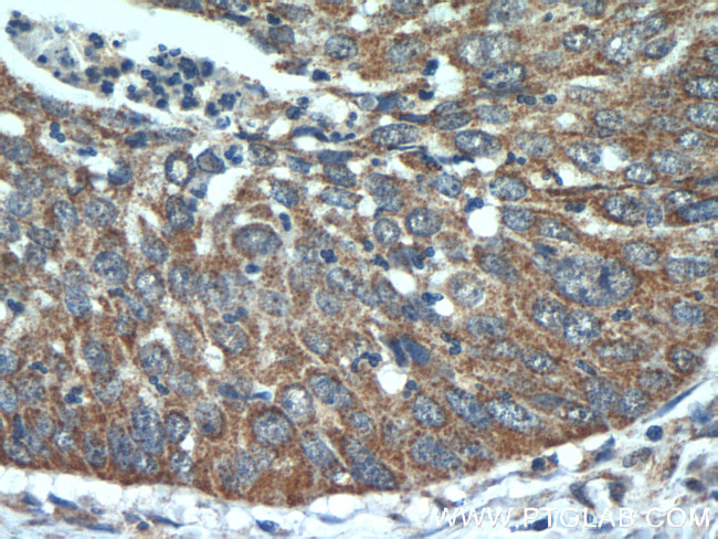 SHMT2 Antibody in Immunohistochemistry (Paraffin) (IHC (P))