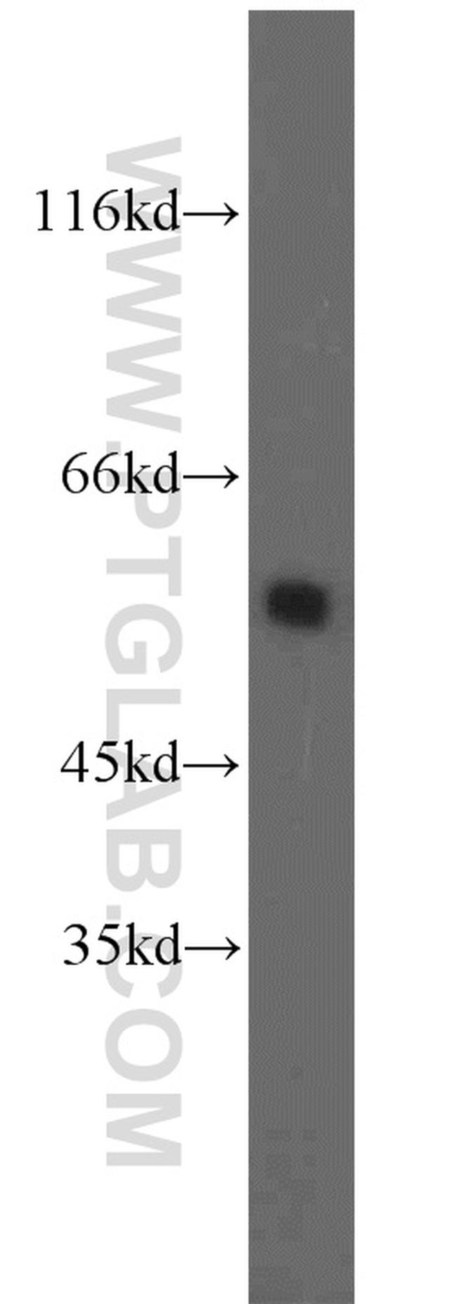 SHMT2 Antibody in Western Blot (WB)