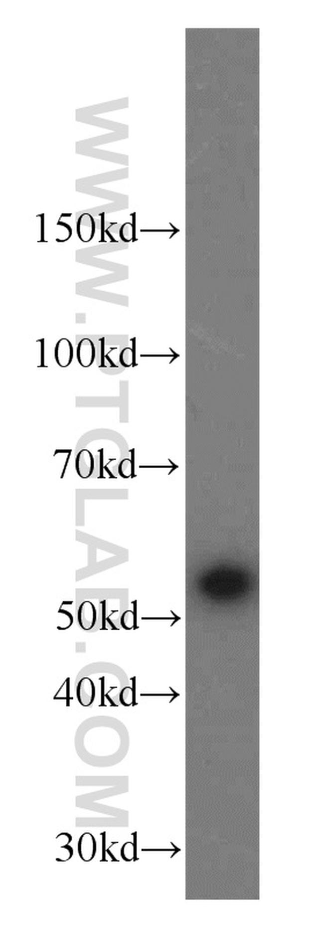 SHMT2 Antibody in Western Blot (WB)