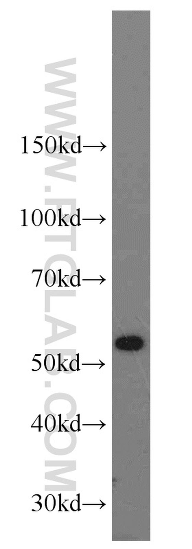 SHMT2 Antibody in Western Blot (WB)