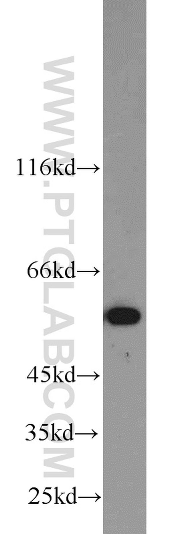 SHMT2 Antibody in Western Blot (WB)