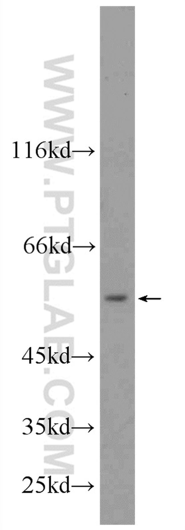 SHMT2 Antibody in Western Blot (WB)