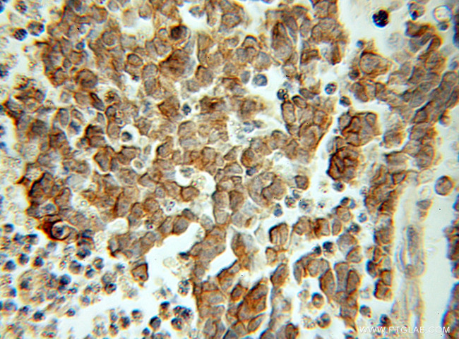 Arrestin C Antibody in Immunohistochemistry (Paraffin) (IHC (P))