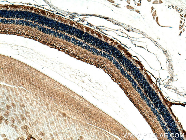 Arrestin C Antibody in Immunohistochemistry (Paraffin) (IHC (P))