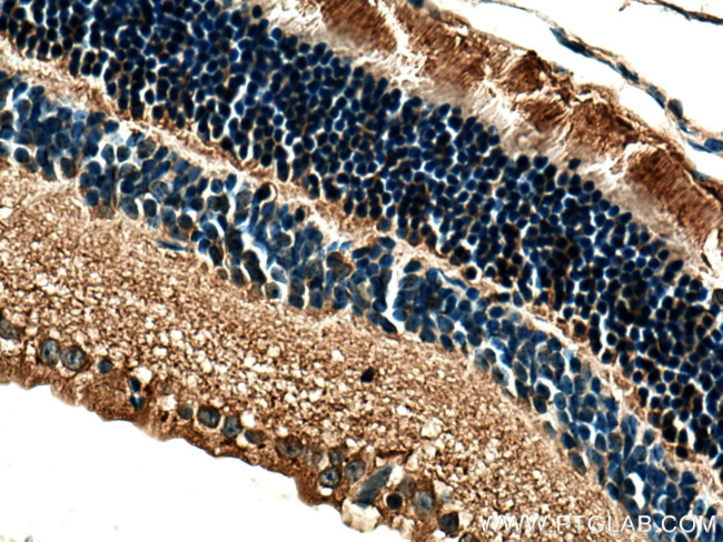 Arrestin C Antibody in Immunohistochemistry (Paraffin) (IHC (P))