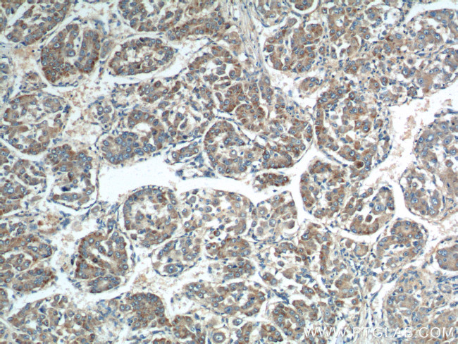 Rab23 Antibody in Immunohistochemistry (Paraffin) (IHC (P))