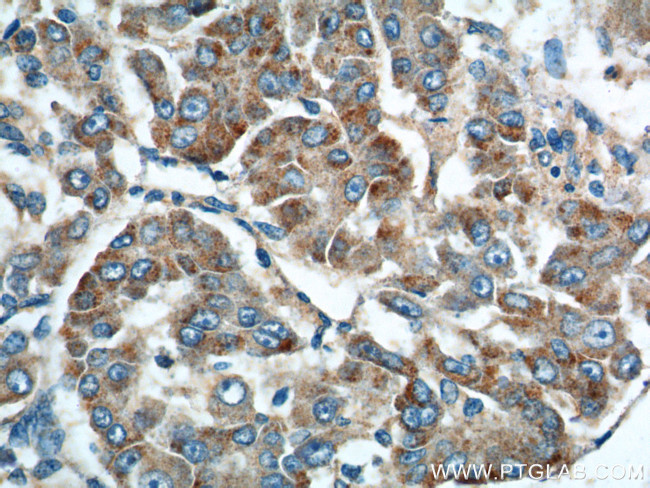 Rab23 Antibody in Immunohistochemistry (Paraffin) (IHC (P))