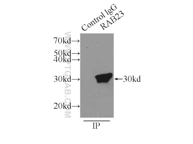 Rab23 Antibody in Immunoprecipitation (IP)