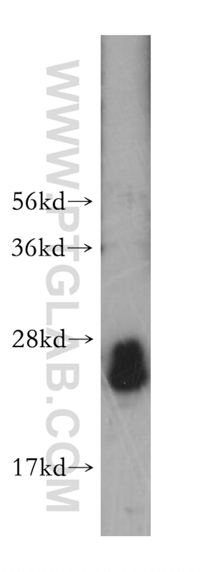 Rab23 Antibody in Western Blot (WB)