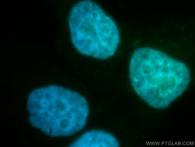 RANGAP1 Antibody in Immunocytochemistry (ICC/IF)