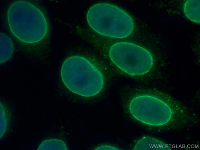 RANGAP1 Antibody in Immunocytochemistry (ICC/IF)