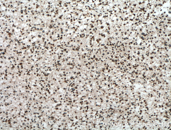 RANGAP1 Antibody in Immunohistochemistry (Paraffin) (IHC (P))