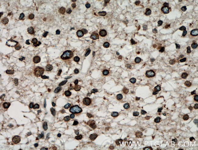 RANGAP1 Antibody in Immunohistochemistry (Paraffin) (IHC (P))