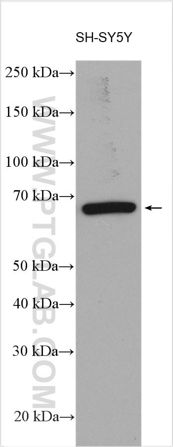 RANGAP1 Antibody in Western Blot (WB)