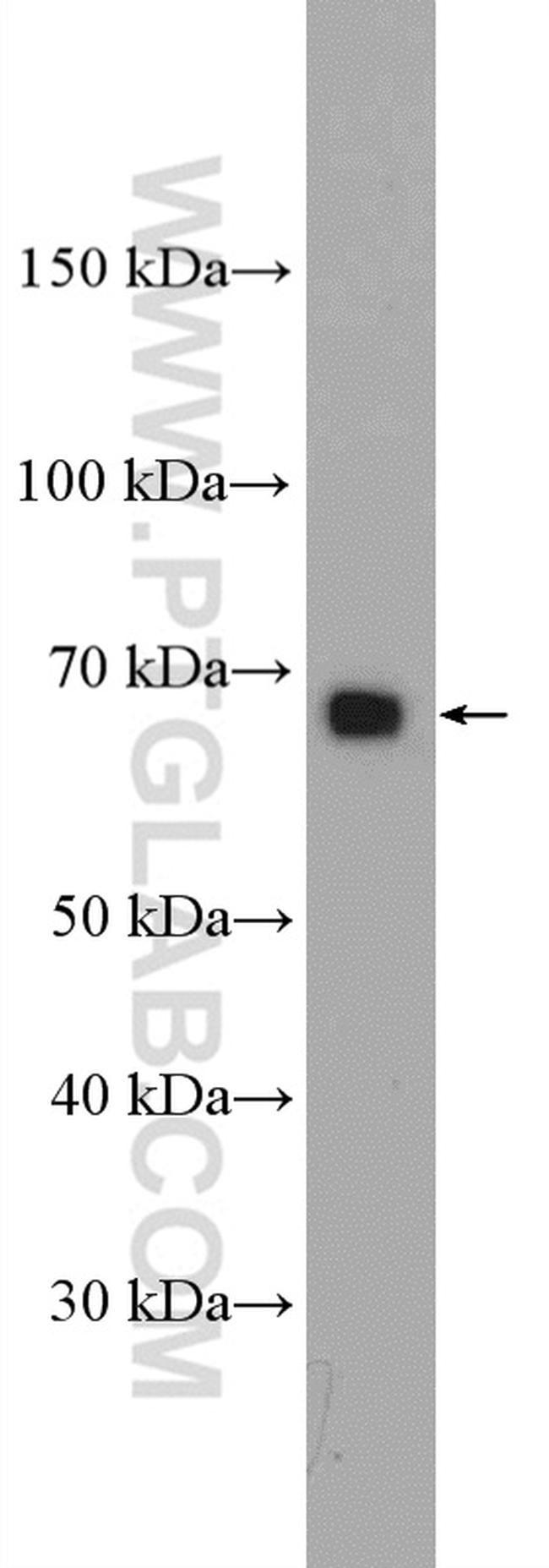 RANGAP1 Antibody in Western Blot (WB)