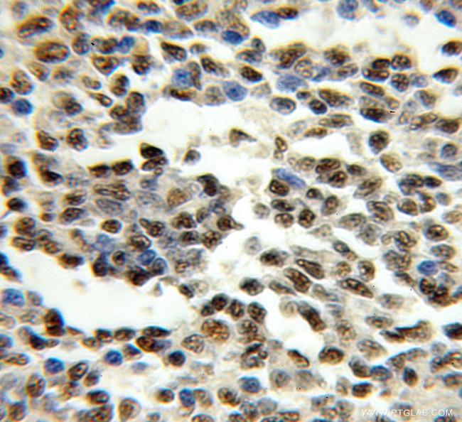 GATA2 Antibody in Immunohistochemistry (Paraffin) (IHC (P))