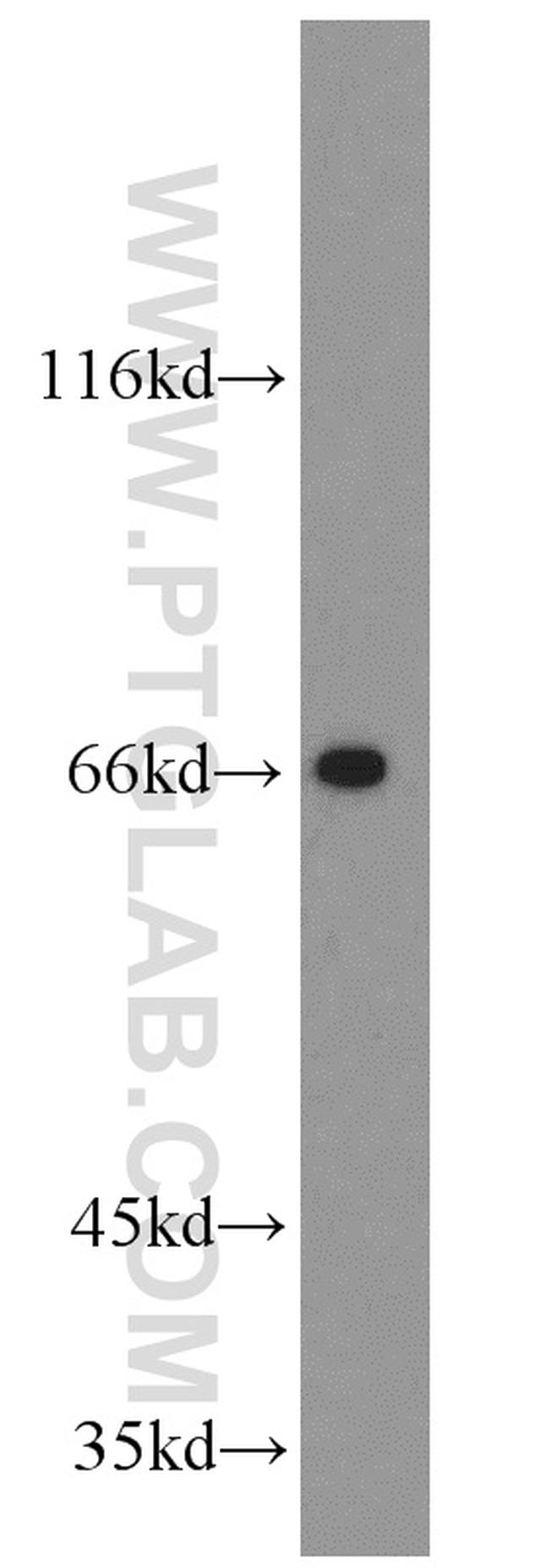 GATA2 Antibody in Western Blot (WB)