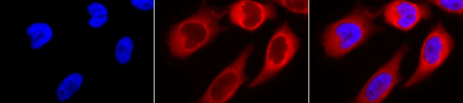 Hsp90 beta Antibody in Immunocytochemistry (ICC/IF)