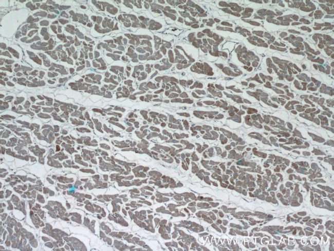 CUL3 Antibody in Immunohistochemistry (Paraffin) (IHC (P))