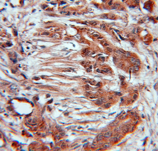 CUL3 Antibody in Immunohistochemistry (Paraffin) (IHC (P))