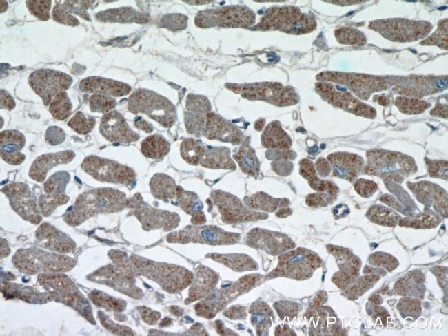 CUL3 Antibody in Immunohistochemistry (Paraffin) (IHC (P))