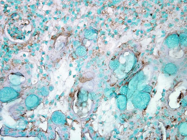 Hsp70 Antibody in Immunohistochemistry (PFA fixed) (IHC (PFA))