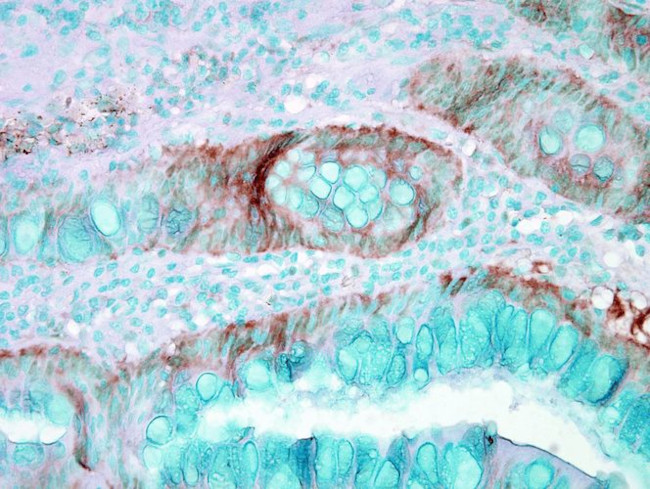 Hsp70 Antibody in Immunohistochemistry (PFA fixed) (IHC (PFA))