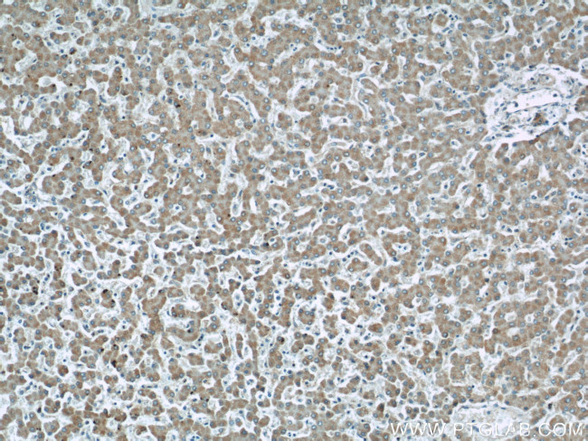 ETFDH Antibody in Immunohistochemistry (Paraffin) (IHC (P))