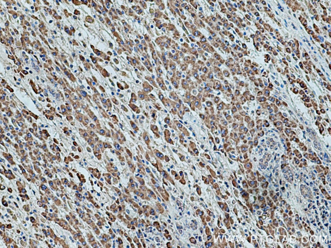 ETFDH Antibody in Immunohistochemistry (Paraffin) (IHC (P))