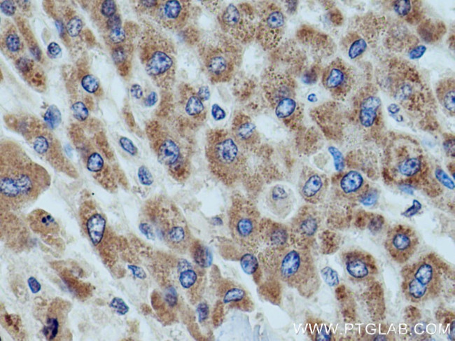 ETFDH Antibody in Immunohistochemistry (Paraffin) (IHC (P))