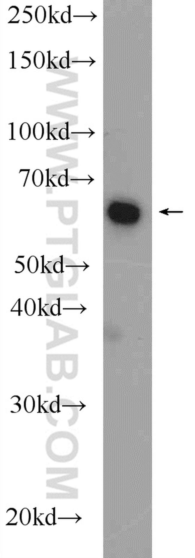 ETFDH Antibody in Western Blot (WB)