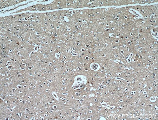 CYLD Antibody in Immunohistochemistry (Paraffin) (IHC (P))