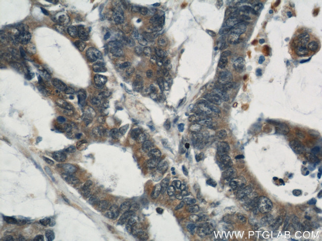 CYLD Antibody in Immunohistochemistry (Paraffin) (IHC (P))