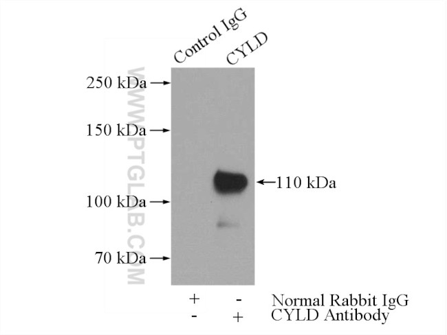 CYLD Antibody in Immunoprecipitation (IP)