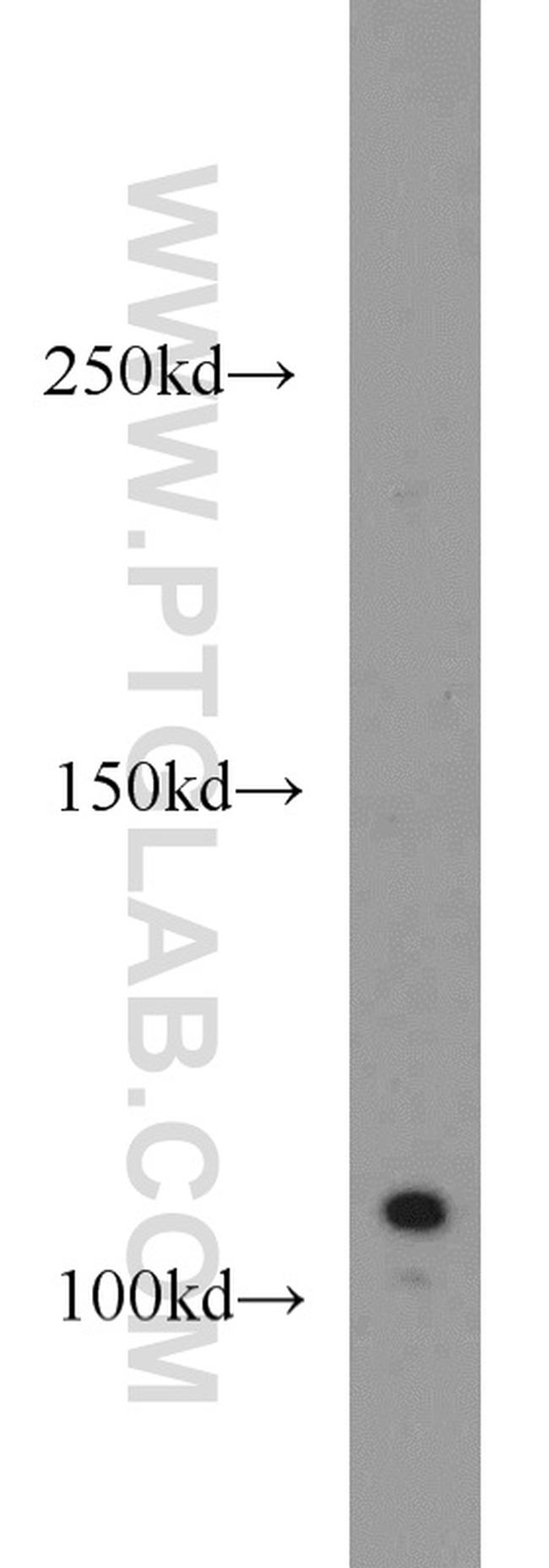 CYLD Antibody in Western Blot (WB)