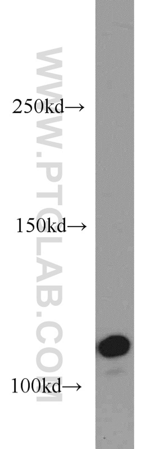 CYLD Antibody in Western Blot (WB)