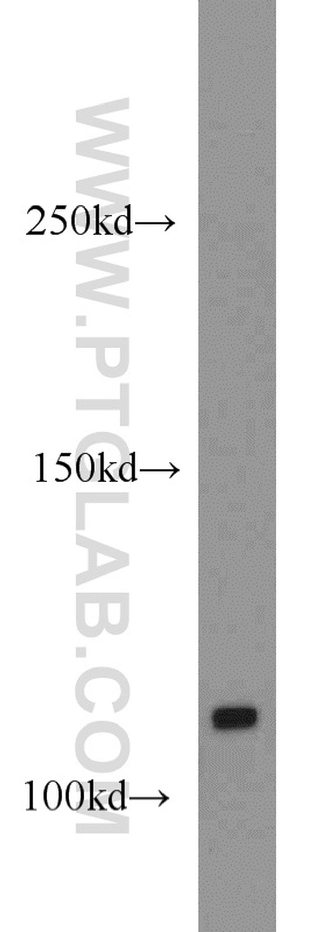 CYLD Antibody in Western Blot (WB)