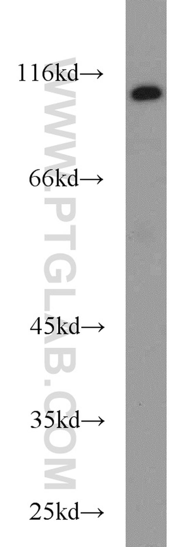 CYLD Antibody in Western Blot (WB)