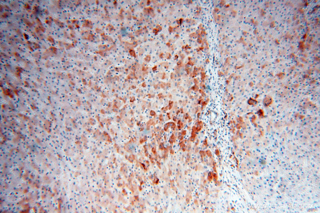 ACAA2 Antibody in Immunohistochemistry (Paraffin) (IHC (P))