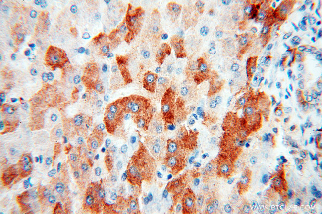 ACAA2 Antibody in Immunohistochemistry (Paraffin) (IHC (P))