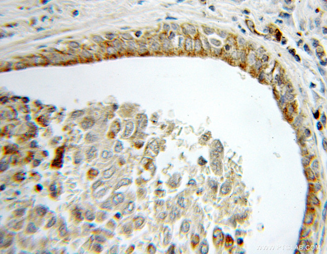 ACAA2 Antibody in Immunohistochemistry (Paraffin) (IHC (P))