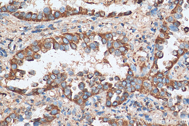 ACAA2 Antibody in Immunohistochemistry (Paraffin) (IHC (P))