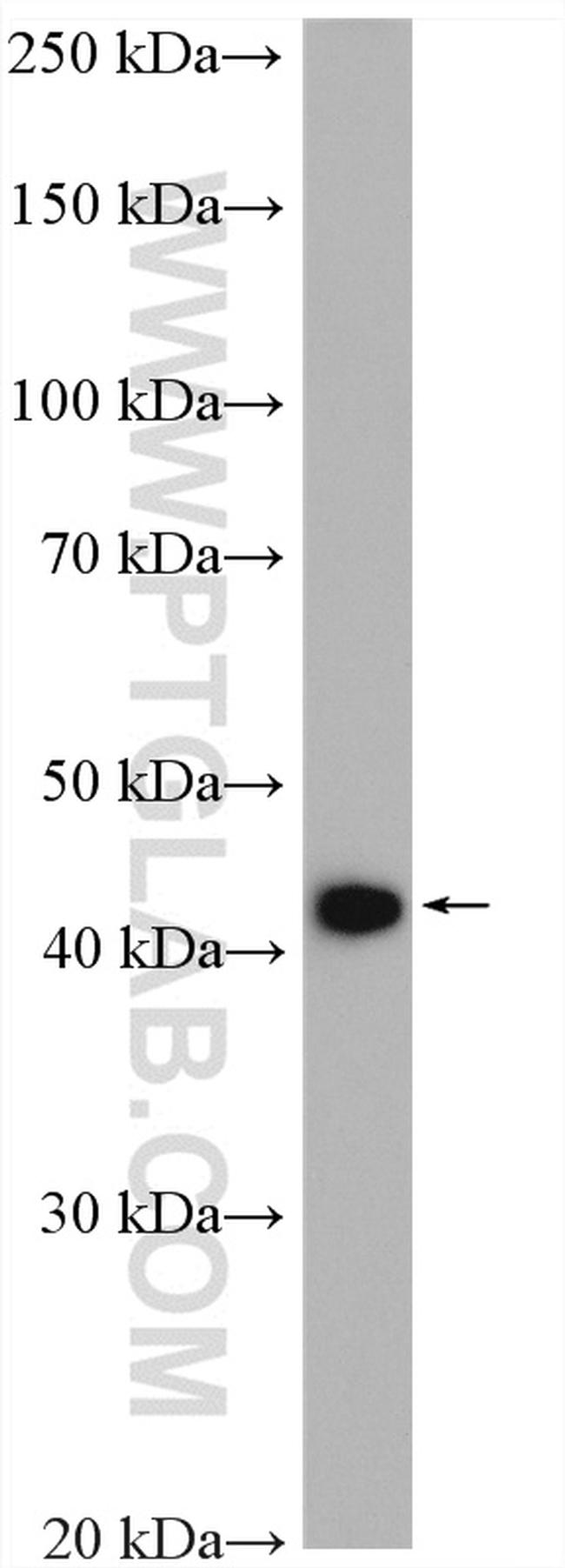 ACAA2 Antibody in Western Blot (WB)